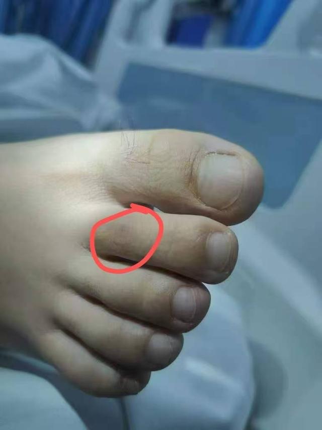 三亞女游客被蛇咬身亡事件帶火蛇類博主兩天漲粉200萬電話被打爆交給朋友接聽(圖8)